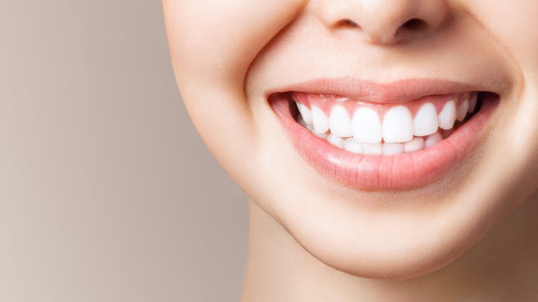 El secreto oculto para blanquear los dientes de forma natural